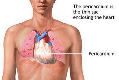 Pericardial Mesothelioma - Normal pericardium